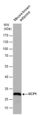 Anti-UCP1 antibody [GT3111] used in Western Blot (WB). GTX632185
